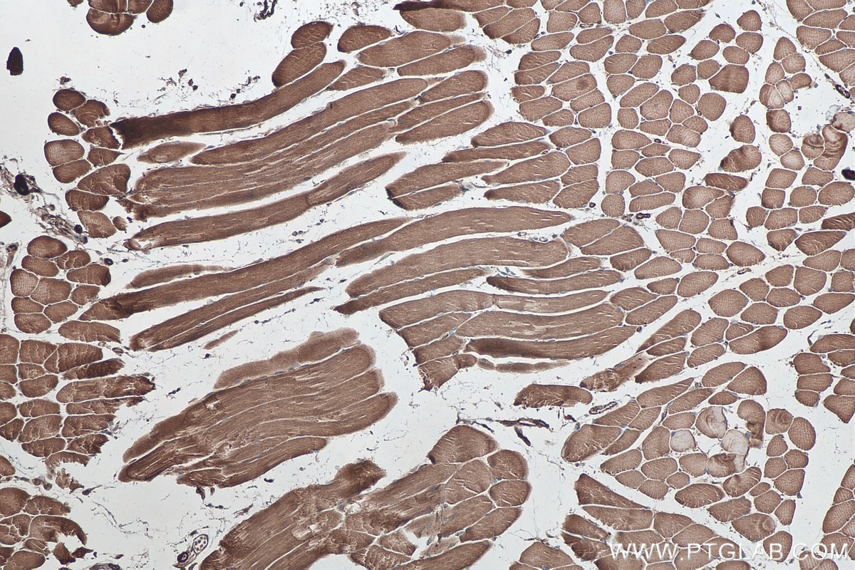 Immunohistochemical analysis of paraffin-embedded mouse skeletal muscle tissue slide using KHC0348 (MYL12A IHC Kit).
