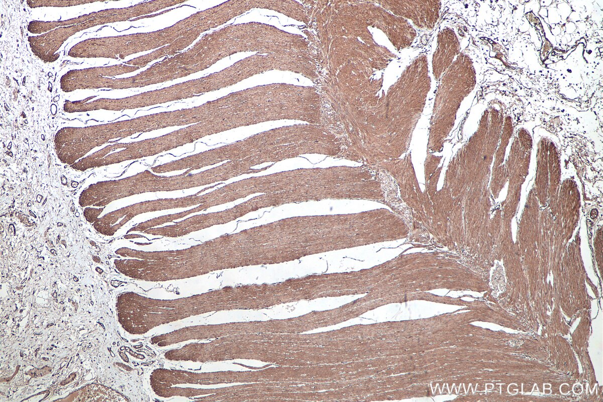 Immunohistochemical analysis of paraffin-embedded human colon tissue slide using KHC0349 (MYL12B IHC Kit).