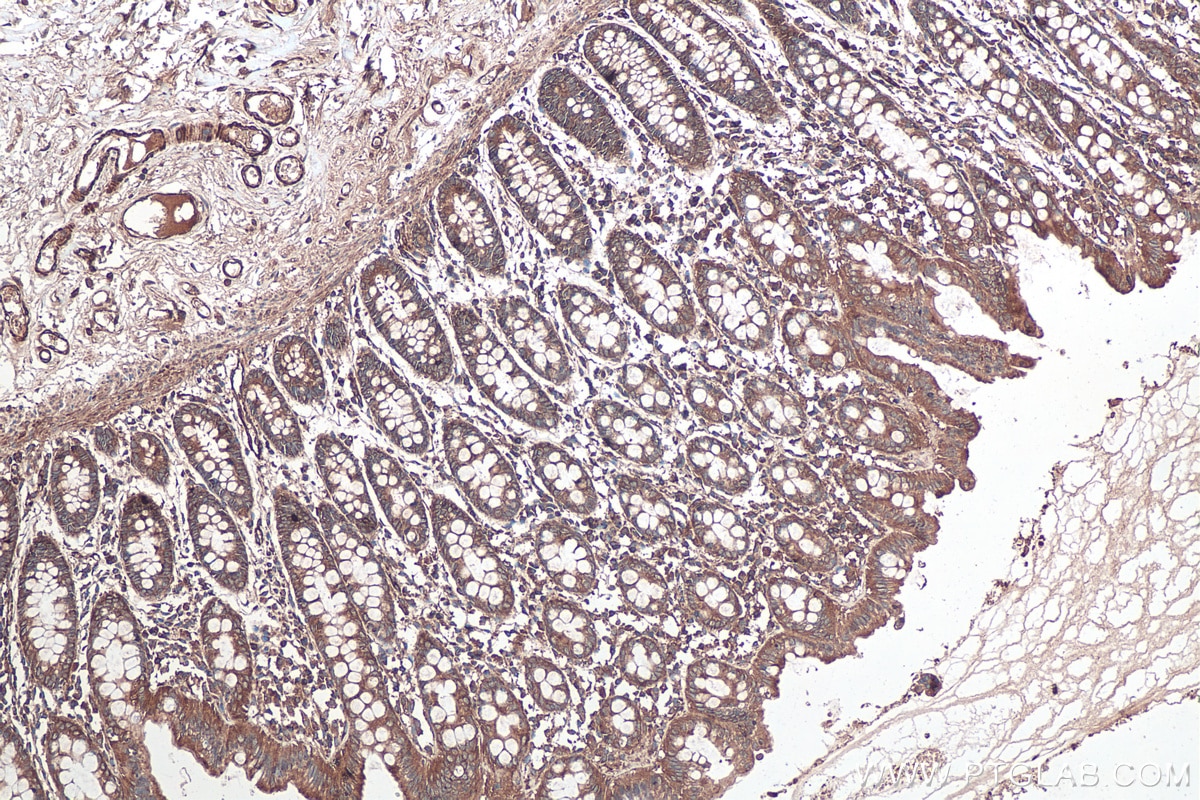 Immunohistochemical analysis of paraffin-embedded human colon tissue slide using KHC0349 (MYL12B IHC Kit).