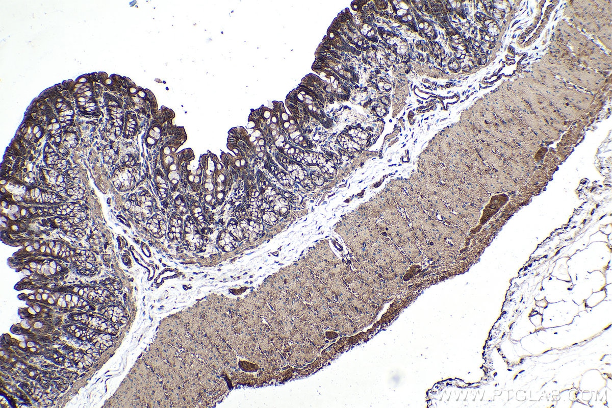 Immunohistochemical analysis of paraffin-embedded rat colon tissue slide using KHC0349 (MYL12B IHC Kit).