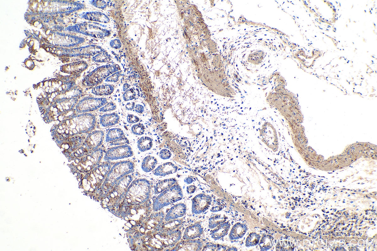 Immunohistochemical analysis of paraffin-embedded mouse colon tissue slide using KHC0349 (MYL12B IHC Kit).