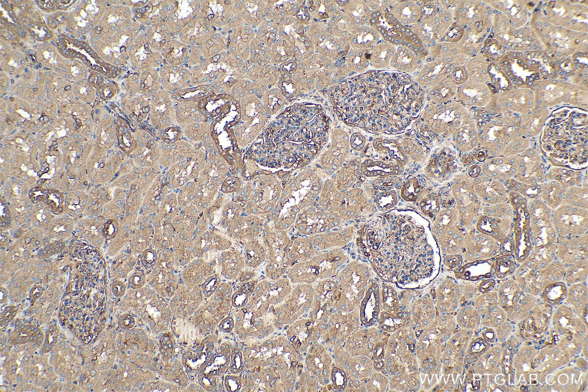 Immunohistochemical analysis of paraffin-embedded human kidney tissue slide using KHC0349 (MYL12B IHC Kit).