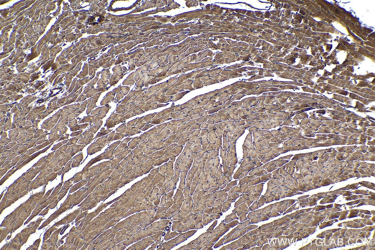 Immunohistochemical analysis of paraffin-embedded mouse heart tissue slide using KHC0349 (MYL12B IHC Kit).