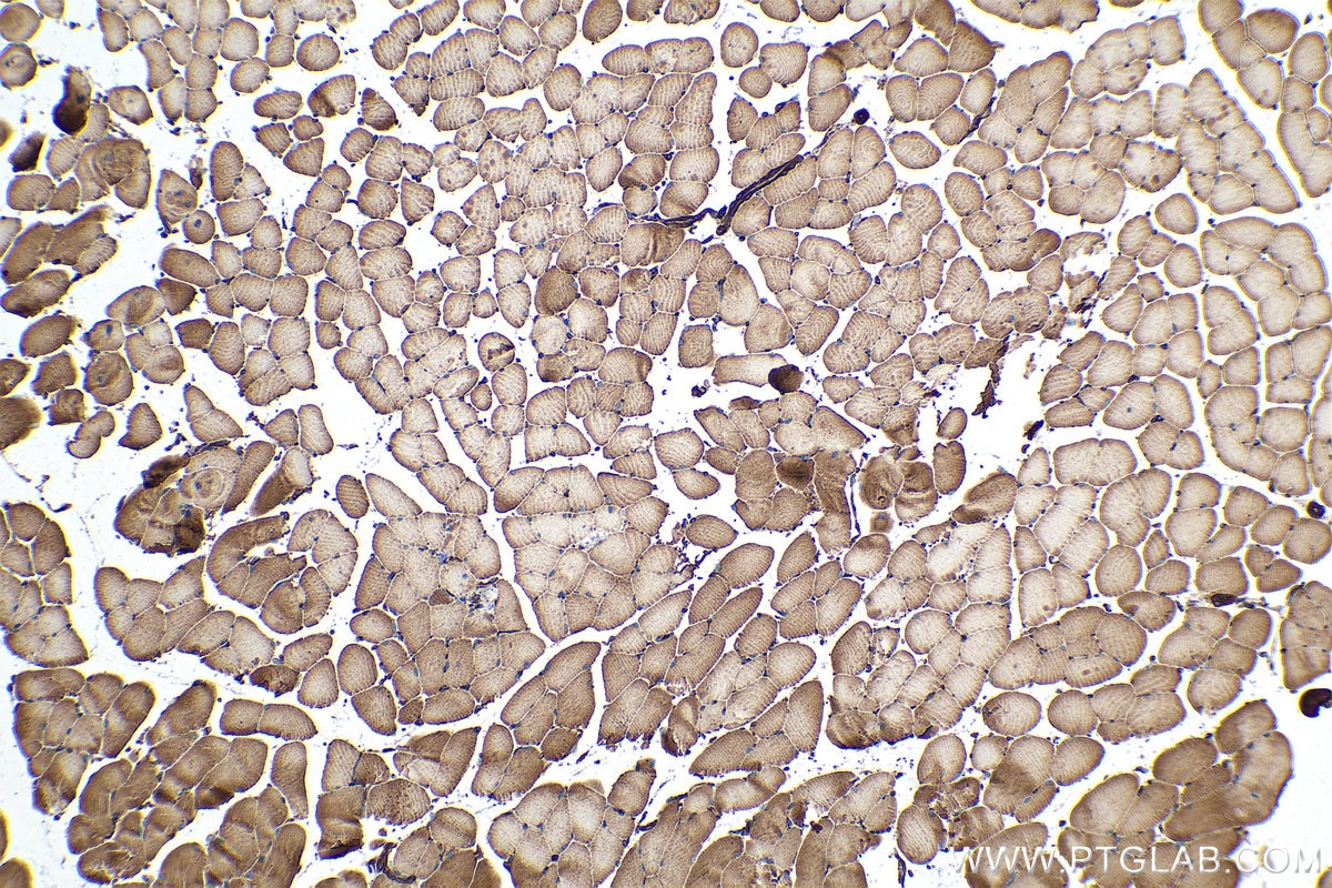Immunohistochemical analysis of paraffin-embedded mouse skeletal muscle tissue slide using KHC0349 (MYL12B IHC Kit).