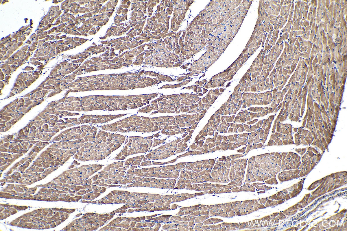 Immunohistochemical analysis of paraffin-embedded rat heart tissue slide using KHC0349 (MYL12B IHC Kit).