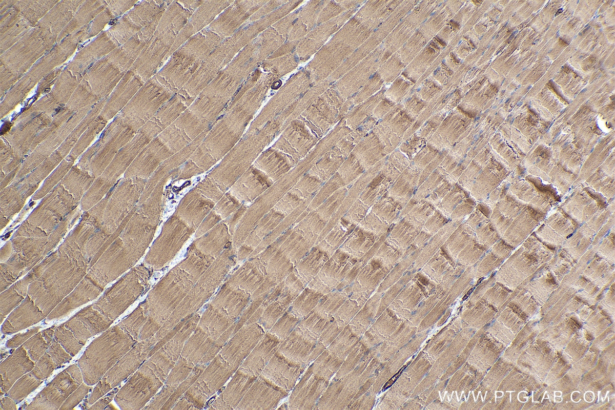 Immunohistochemical analysis of paraffin-embedded rat skeletal muscle tissue slide using KHC0349 (MYL12B IHC Kit).