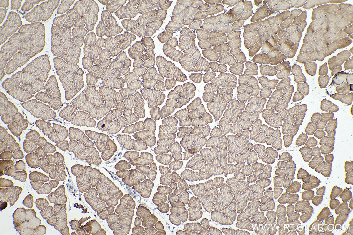 Immunohistochemical analysis of paraffin-embedded mouse skeletal muscle tissue slide using KHC0338 (MYL3 IHC Kit).