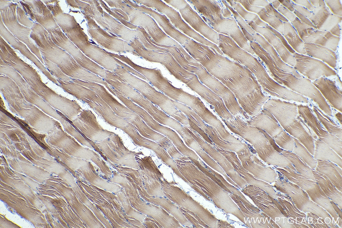 Immunohistochemical analysis of paraffin-embedded rat skeletal muscle tissue slide using KHC0340 (MYL5 IHC Kit).