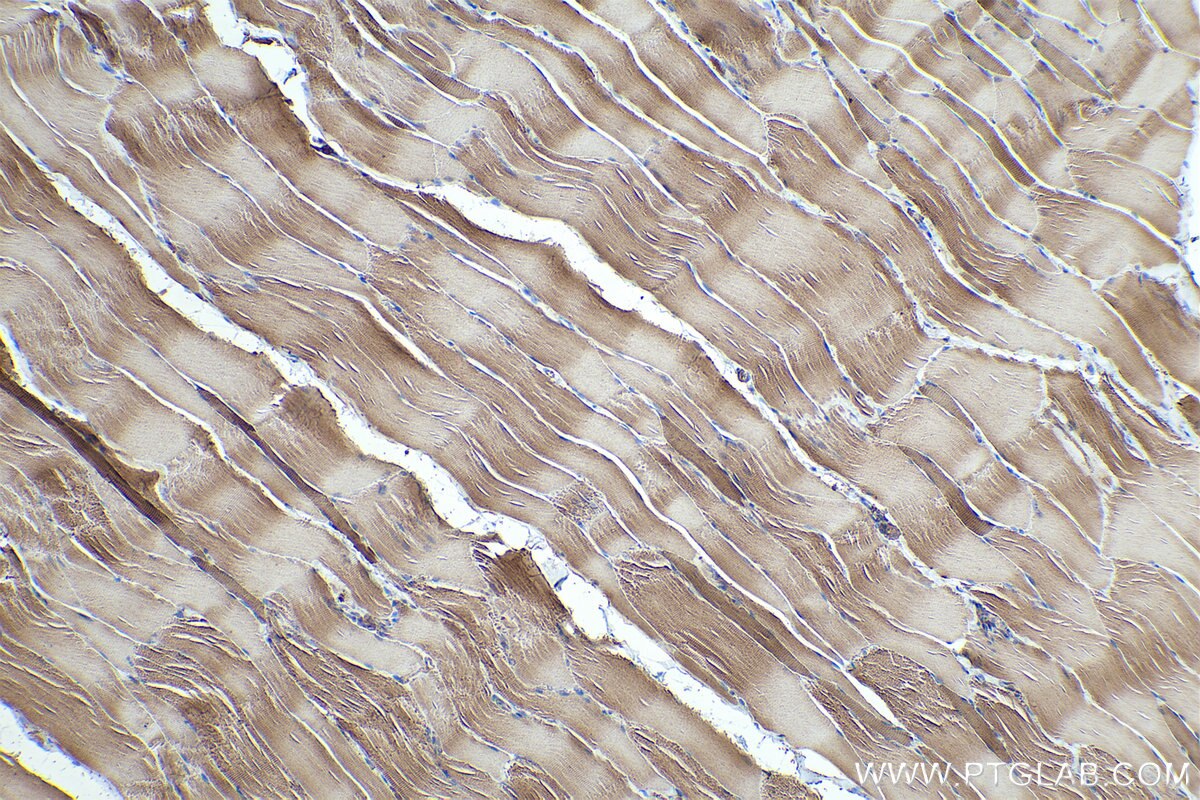 Immunohistochemical analysis of paraffin-embedded rat skeletal muscle tissue slide using KHC0340 (MYL5 IHC Kit).