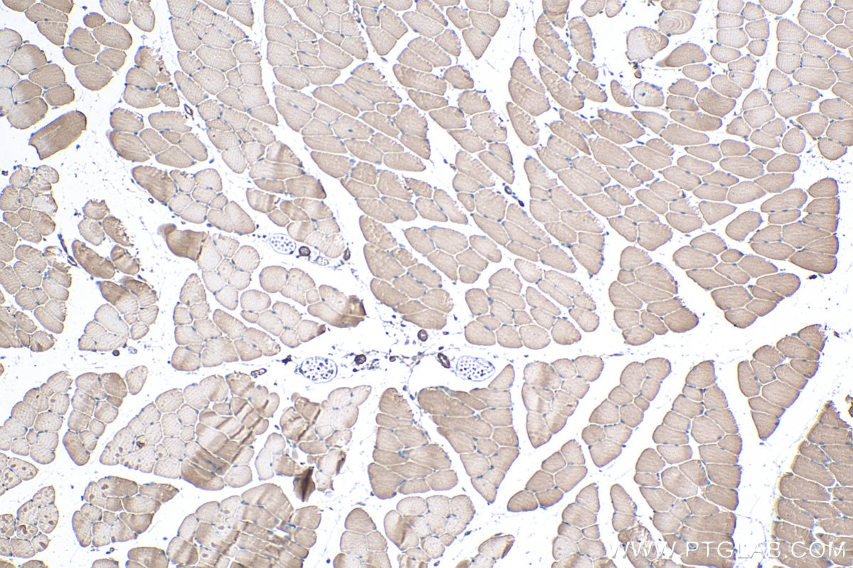 Immunohistochemical analysis of paraffin-embedded mouse skeletal muscle tissue slide using KHC0340 (MYL5 IHC Kit).