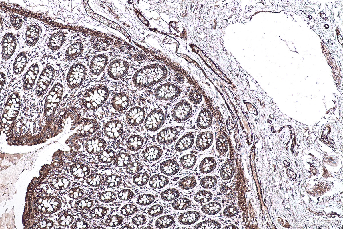 Immunohistochemical analysis of paraffin-embedded human colon tissue slide using KHC0342 (MYL6 IHC Kit).