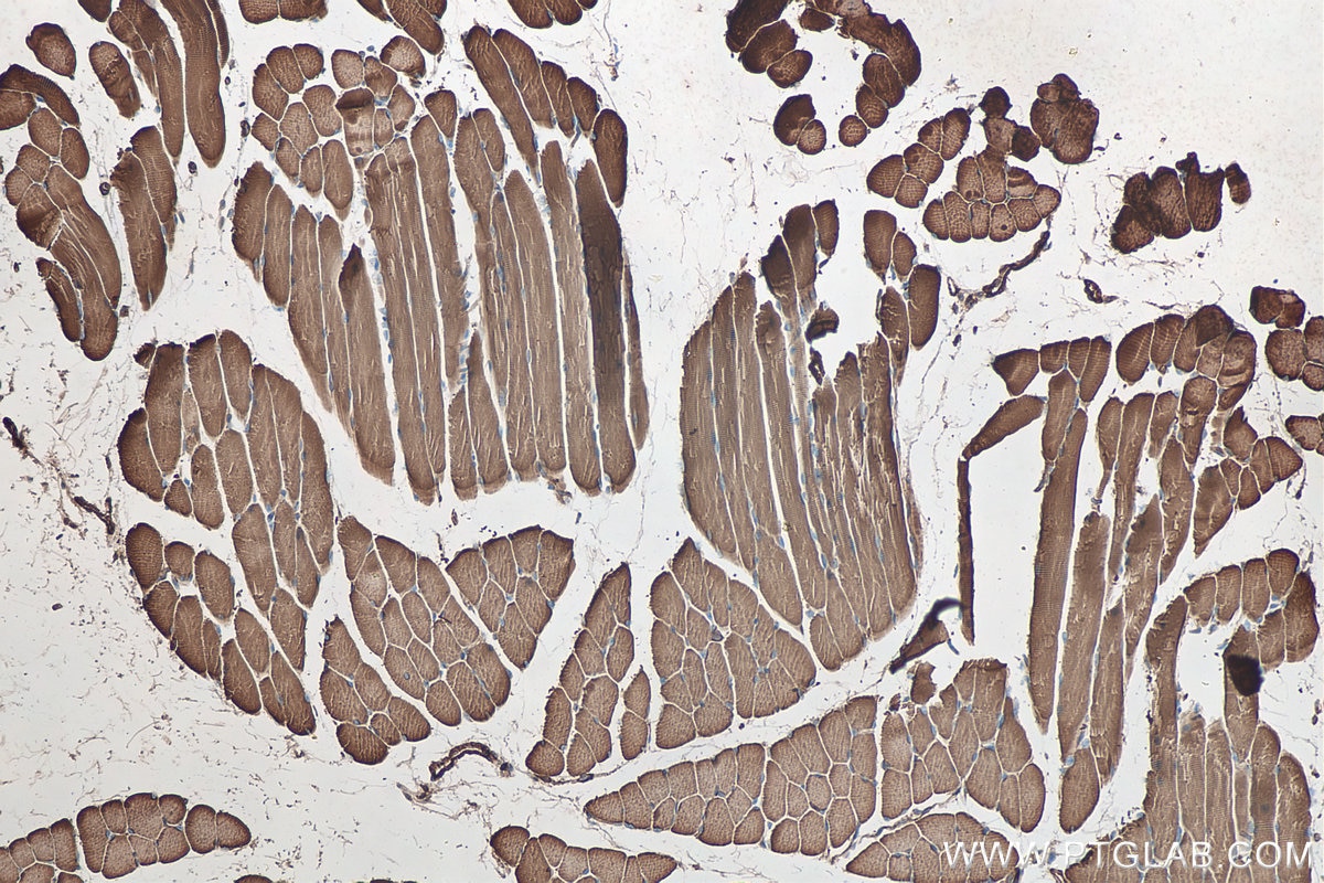 Immunohistochemical analysis of paraffin-embedded mouse skeletal muscle tissue slide using KHC0342 (MYL6 IHC Kit).