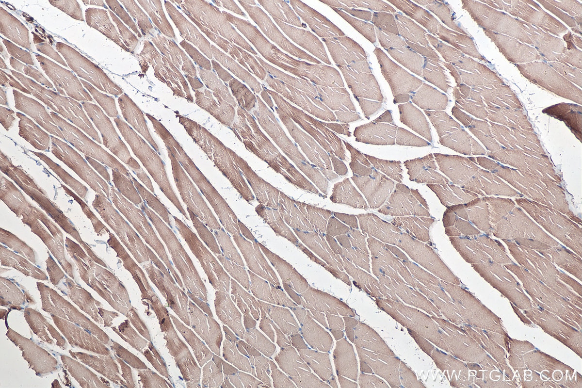 Immunohistochemical analysis of paraffin-embedded rat skeletal muscle tissue slide using KHC0342 (MYL6 IHC Kit).