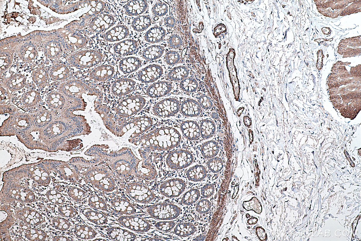 Immunohistochemical analysis of paraffin-embedded human colon tissue slide using KHC0345 (MYL9 IHC Kit).