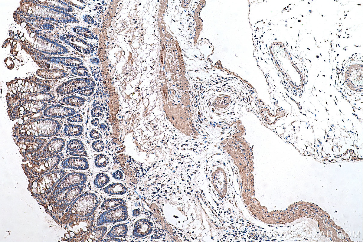 Immunohistochemical analysis of paraffin-embedded mouse colon tissue slide using KHC0345 (MYL9 IHC Kit).