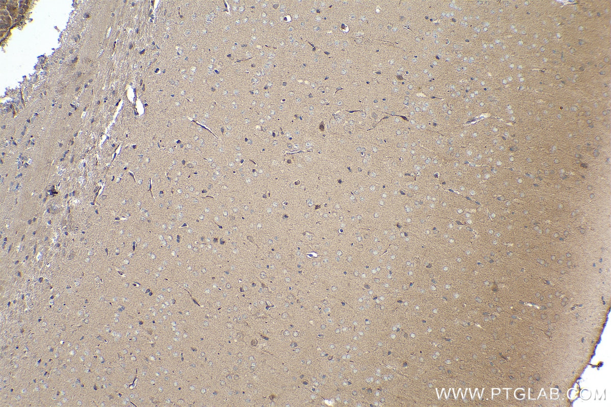 Immunohistochemical analysis of paraffin-embedded mouse brain tissue slide using KHC0359 (MYO16 IHC Kit).