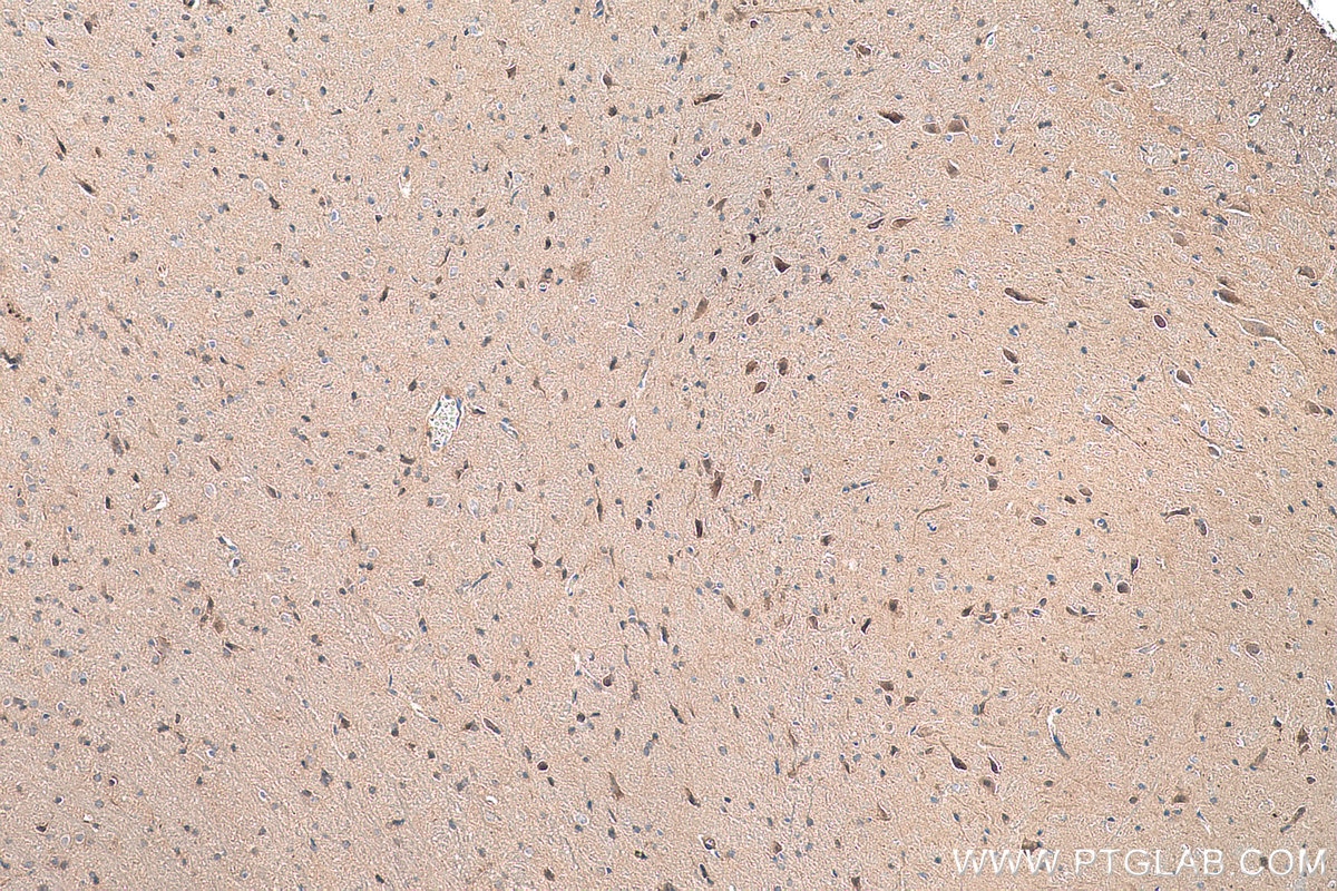 Immunohistochemical analysis of paraffin-embedded rat brain tissue slide using KHC0359 (MYO16 IHC Kit).