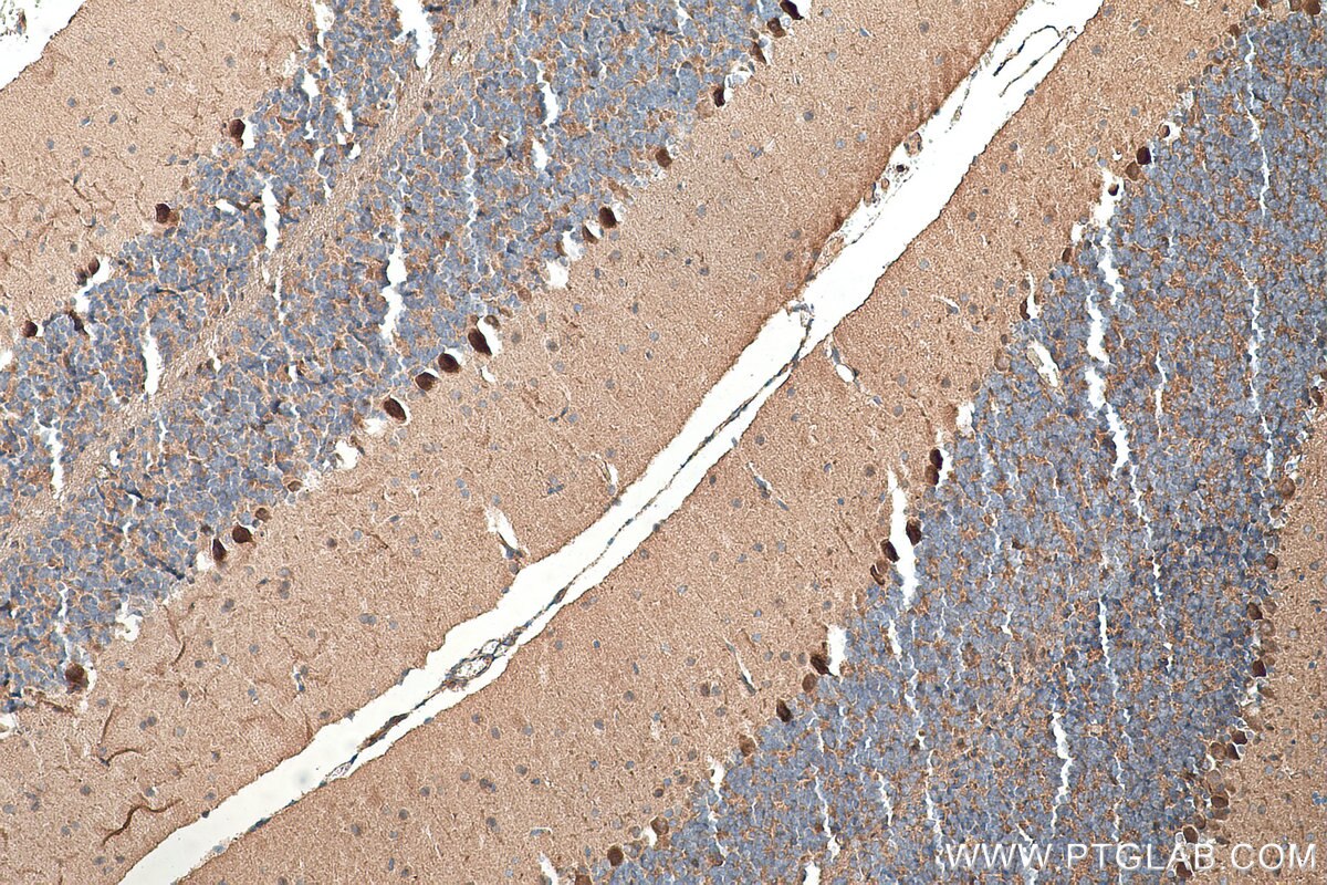 Immunohistochemical analysis of paraffin-embedded mouse cerebellum tissue slide using KHC0359 (MYO16 IHC Kit).