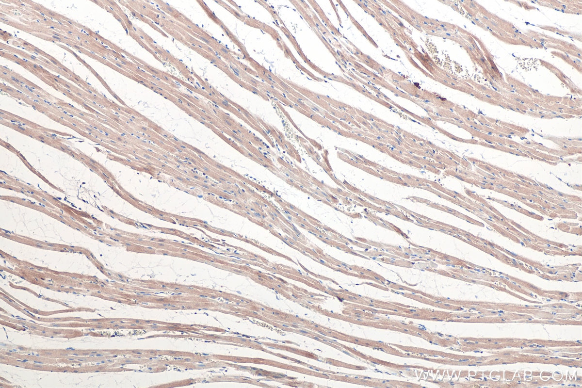 Immunohistochemical analysis of paraffin-embedded rat heart tissue slide using KHC0360 (MYO18A IHC Kit).