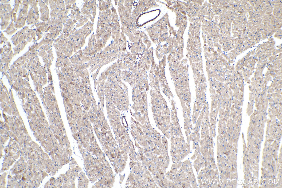 Immunohistochemical analysis of paraffin-embedded mouse heart tissue slide using KHC0361 (MYO18B IHC Kit).