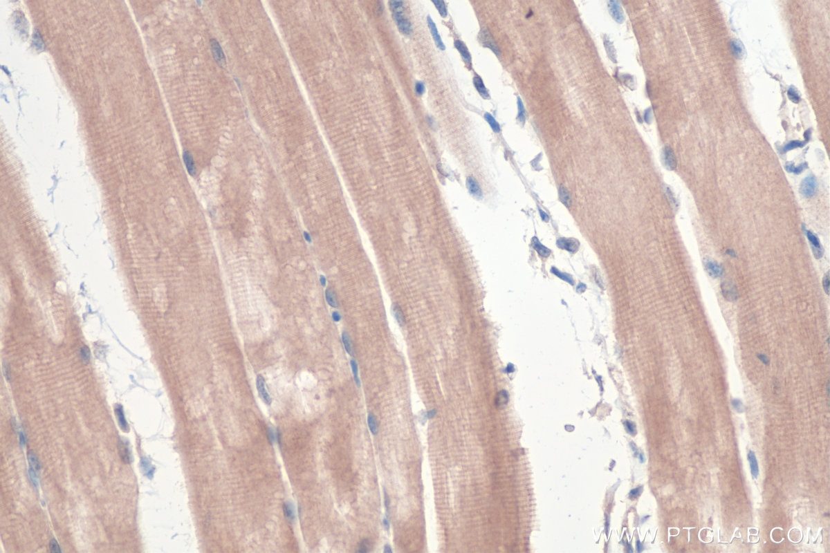 Immunohistochemical analysis of paraffin-embedded mouse skeletal muscle tissue slide using KHC0361 (MYO18B IHC Kit).