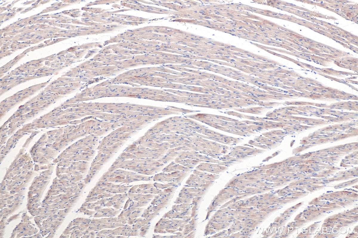 Immunohistochemical analysis of paraffin-embedded rat heart tissue slide using KHC0361 (MYO18B IHC Kit).