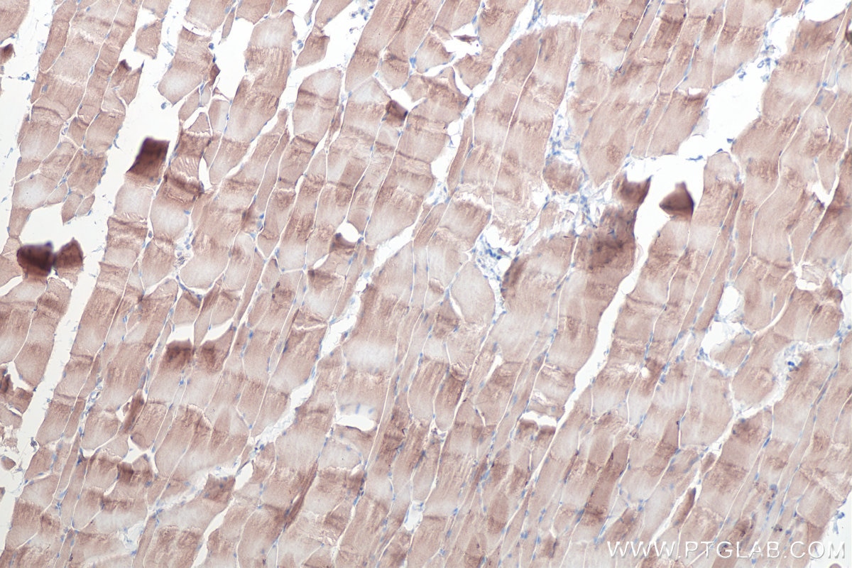 Immunohistochemical analysis of paraffin-embedded rat skeletal muscle tissue slide using KHC0361 (MYO18B IHC Kit).