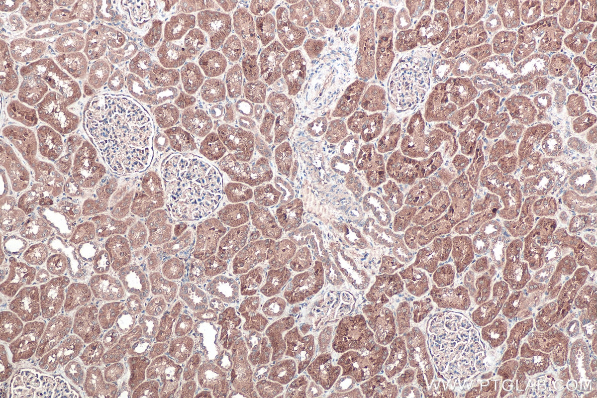 Immunohistochemical analysis of paraffin-embedded human kidney tissue slide using KHC0362 (MYO19 IHC Kit).