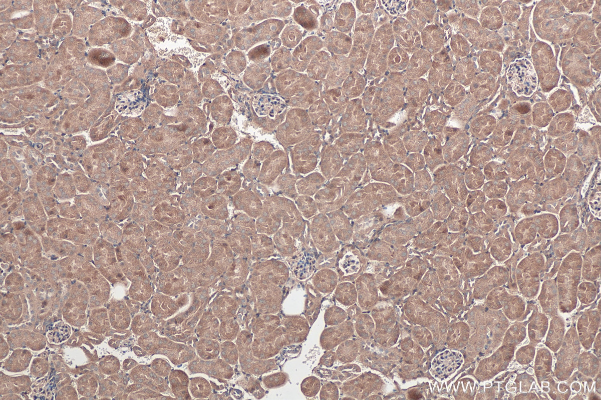 Immunohistochemical analysis of paraffin-embedded mouse kidney tissue slide using KHC0362 (MYO19 IHC Kit).