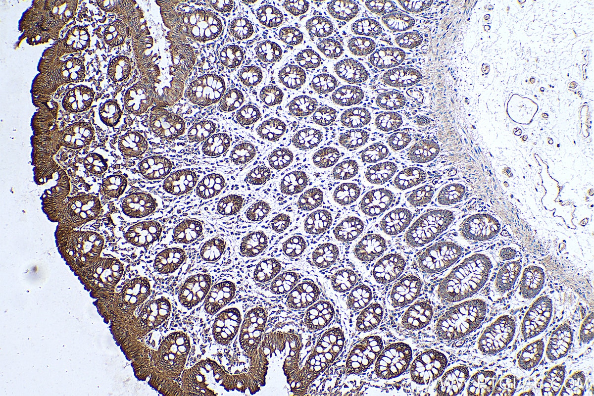 Immunohistochemical analysis of paraffin-embedded human colon tissue slide using KHC0353 (MYO1C IHC Kit).