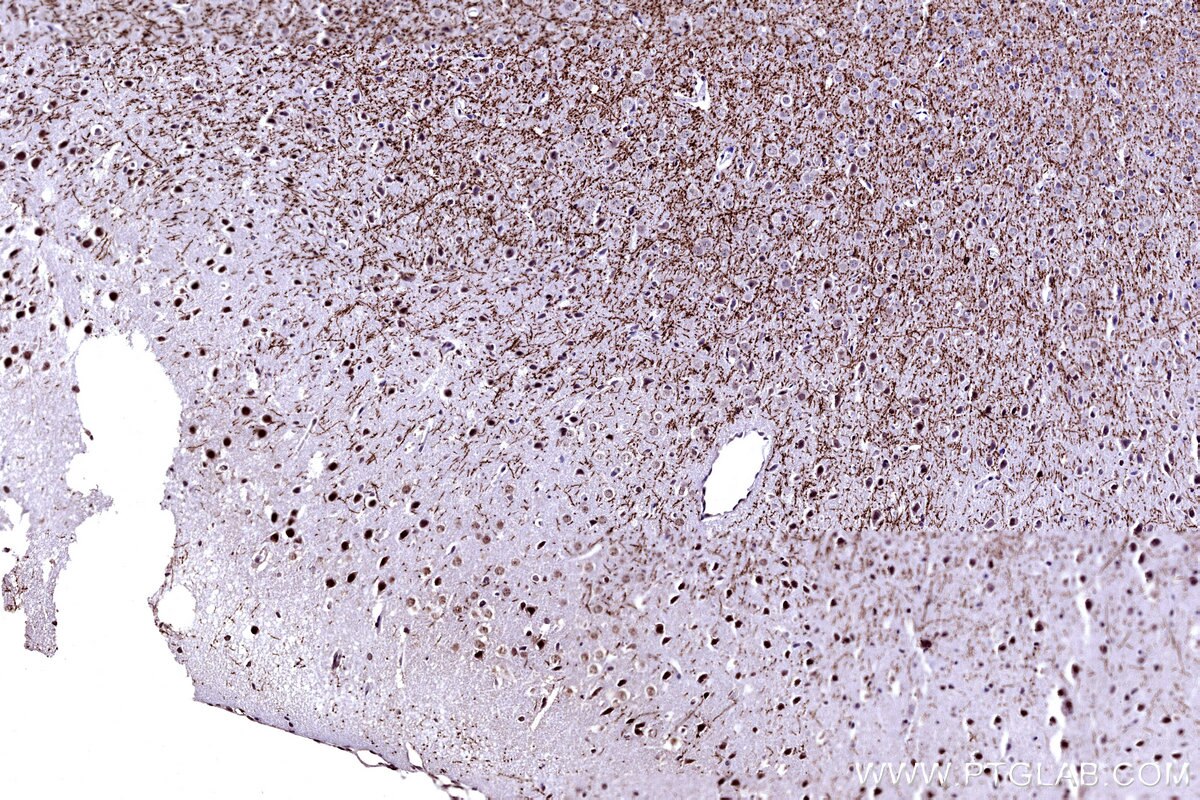 Immunohistochemical analysis of paraffin-embedded mouse brain tissue slide using KHC3152 (MYO1D IHC Kit). Immunohistochemical analysis of paraffin-embedded mouse brain tissue slide using KHC3152 (MYO1D IHC Kit).