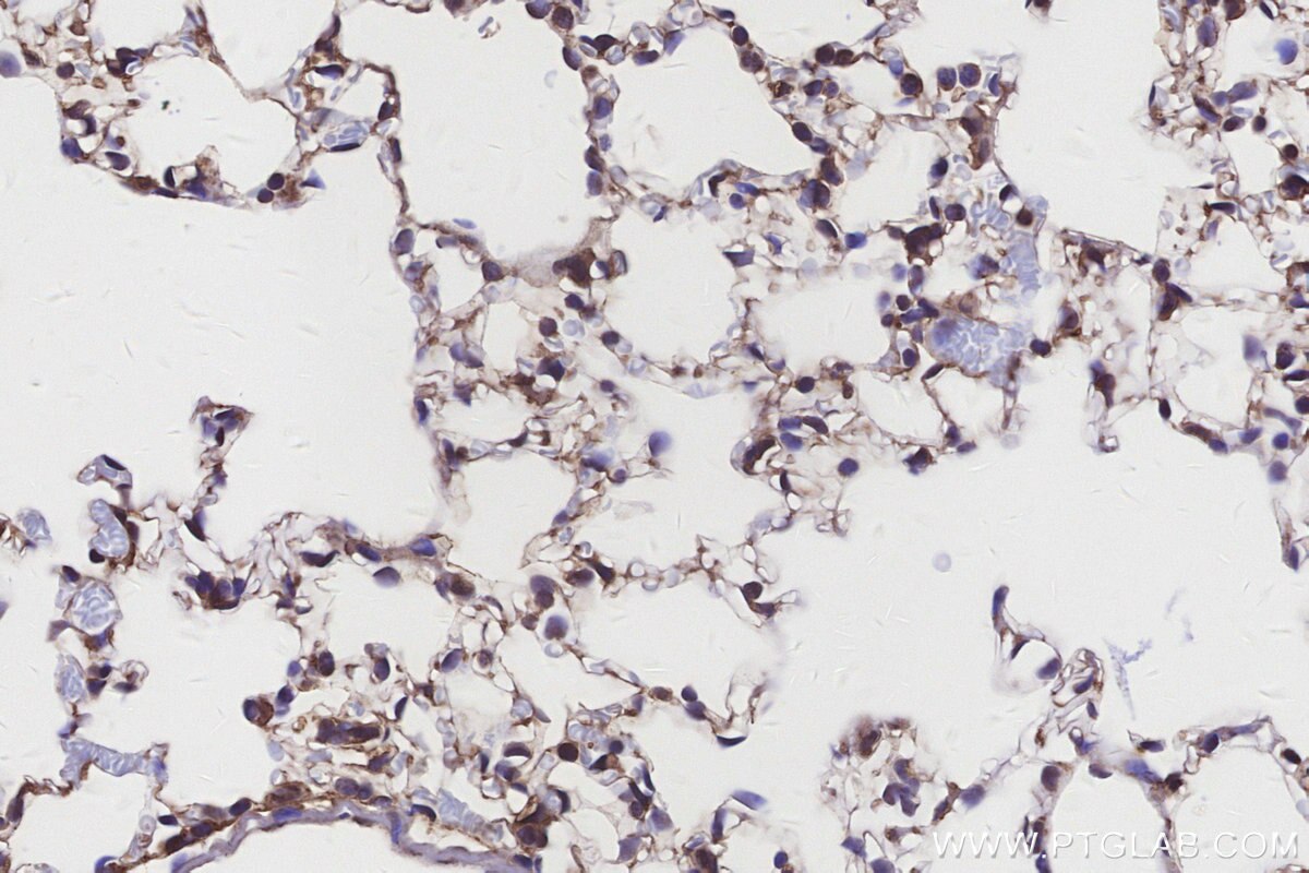 Immunohistochemical analysis of paraffin-embedded mouse lung tissue slide using KHC3152 (MYO1D IHC Kit). Immunohistochemical analysis of paraffin-embedded mouse lung tissue slide using KHC3152 (MYO1D IHC Kit).