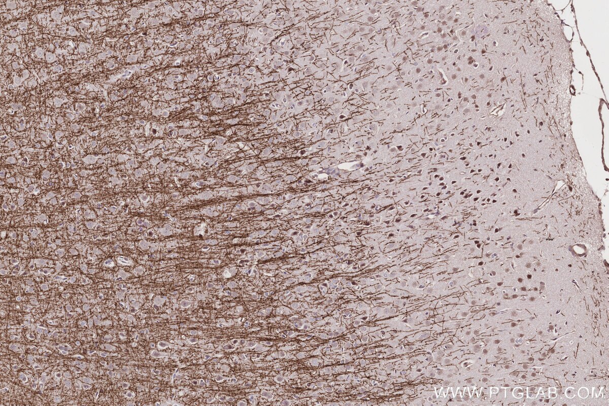 Immunohistochemical analysis of paraffin-embedded rat brain tissue slide using KHC3152 (MYO1D IHC Kit). Immunohistochemical analysis of paraffin-embedded rat brain tissue slide using KHC3152 (MYO1D IHC Kit).