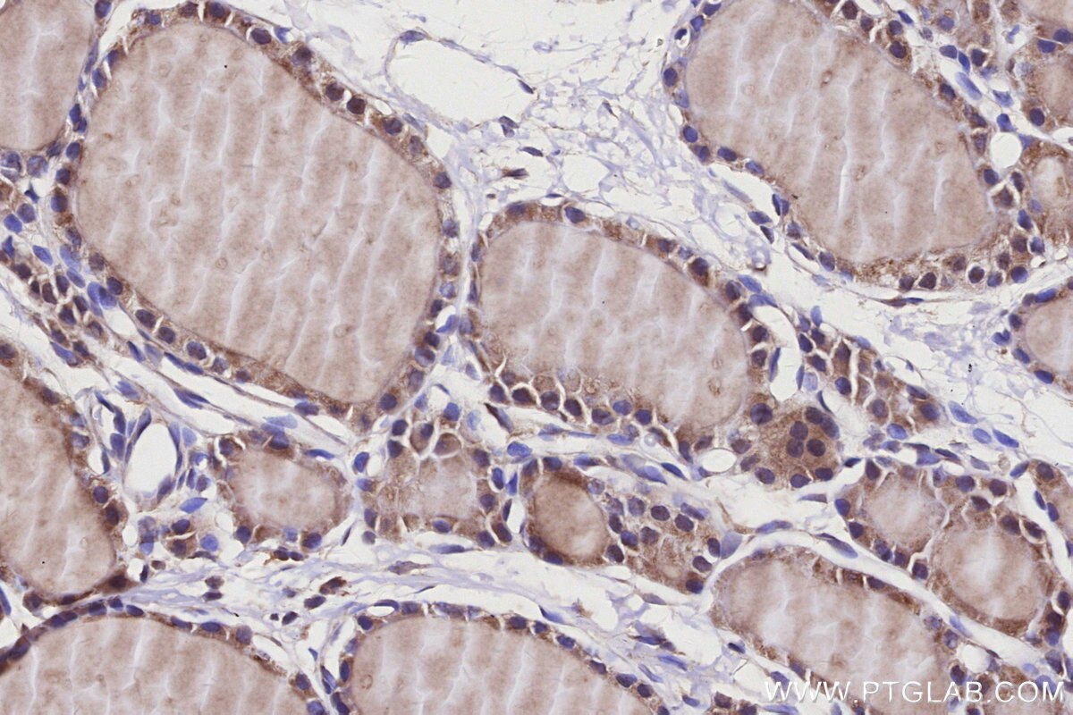 Immunohistochemical analysis of paraffin-embedded rat thyroid gland tissue slide using KHC3152 (MYO1D IHC Kit). Immunohistochemical analysis of paraffin-embedded rat thyroid gland tissue slide using KHC3152 (MYO1D IHC Kit).