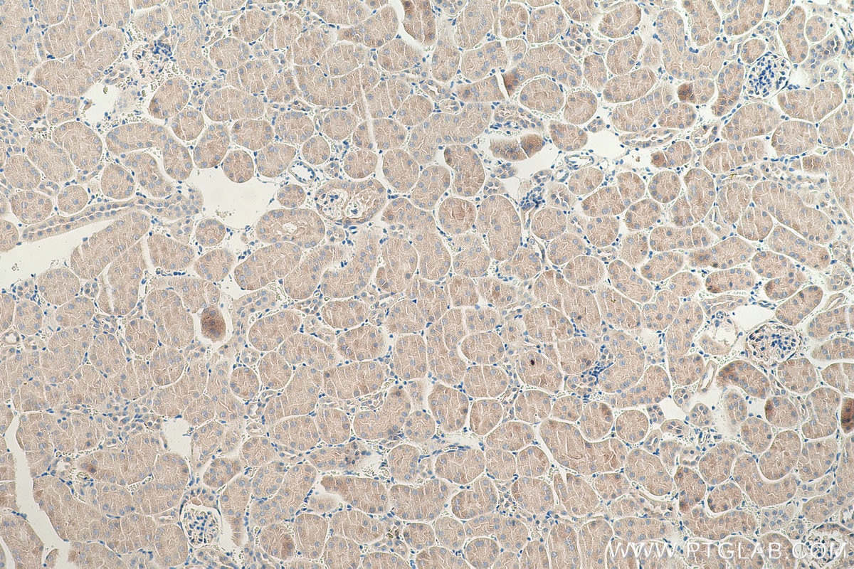Immunohistochemical analysis of paraffin-embedded mouse kidney tissue slide using KHC0354 (MYO1E IHC Kit).