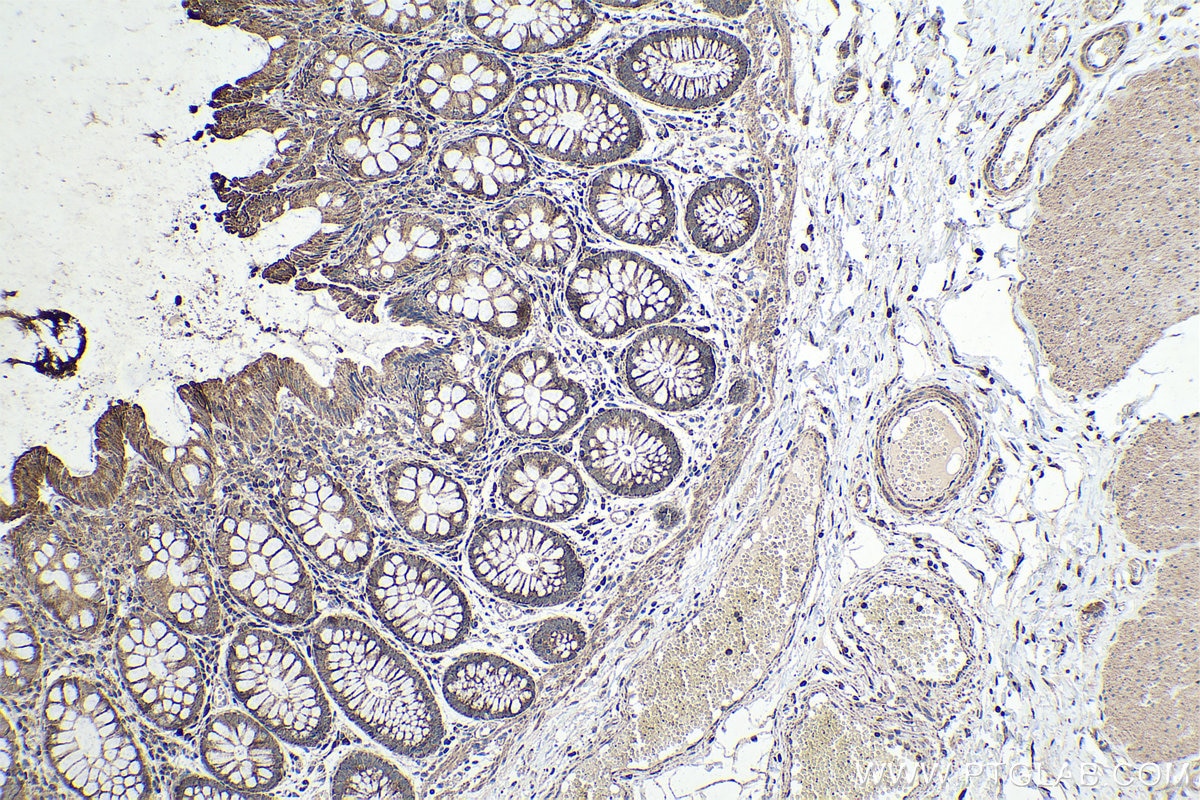 Immunohistochemical analysis of paraffin-embedded human colon tissue slide using KHC0356 (MYO5B IHC Kit).