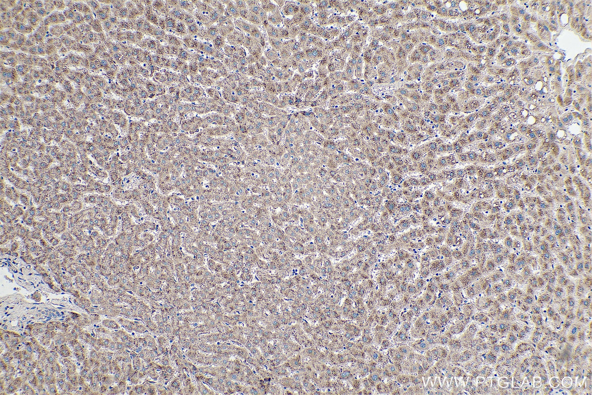 Immunohistochemical analysis of paraffin-embedded human liver tissue slide using KHC0356 (MYO5B IHC Kit).