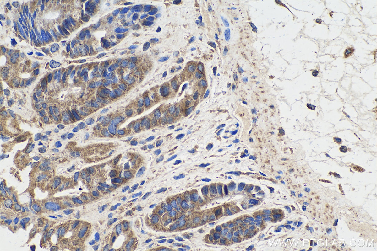 Immunohistochemical analysis of paraffin-embedded mouse colon tissue slide using KHC0356 (MYO5B IHC Kit).