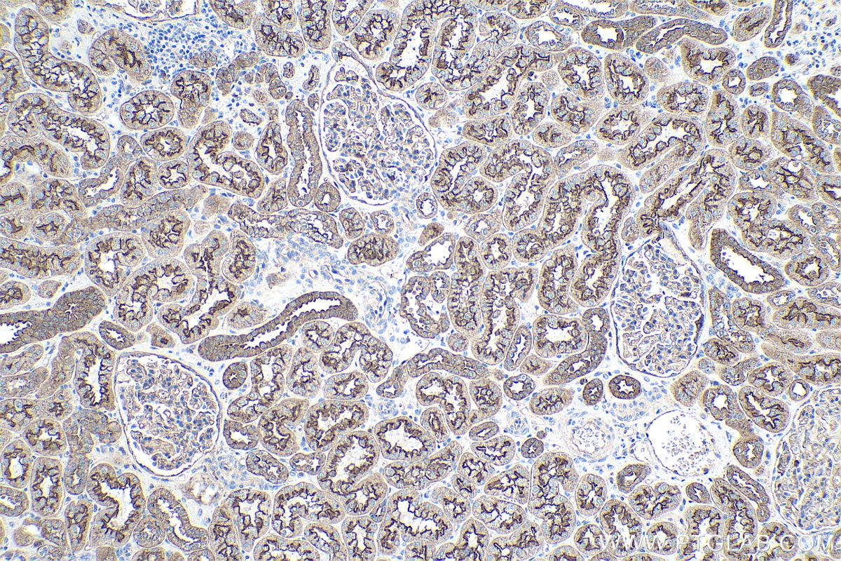 Immunohistochemical analysis of paraffin-embedded human kidney tissue slide using KHC0357 (MYO6 IHC Kit).