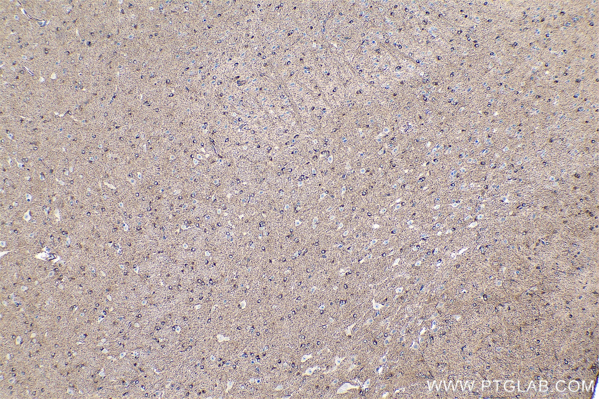 Immunohistochemical analysis of paraffin-embedded mouse brain tissue slide using KHC0357 (MYO6 IHC Kit).