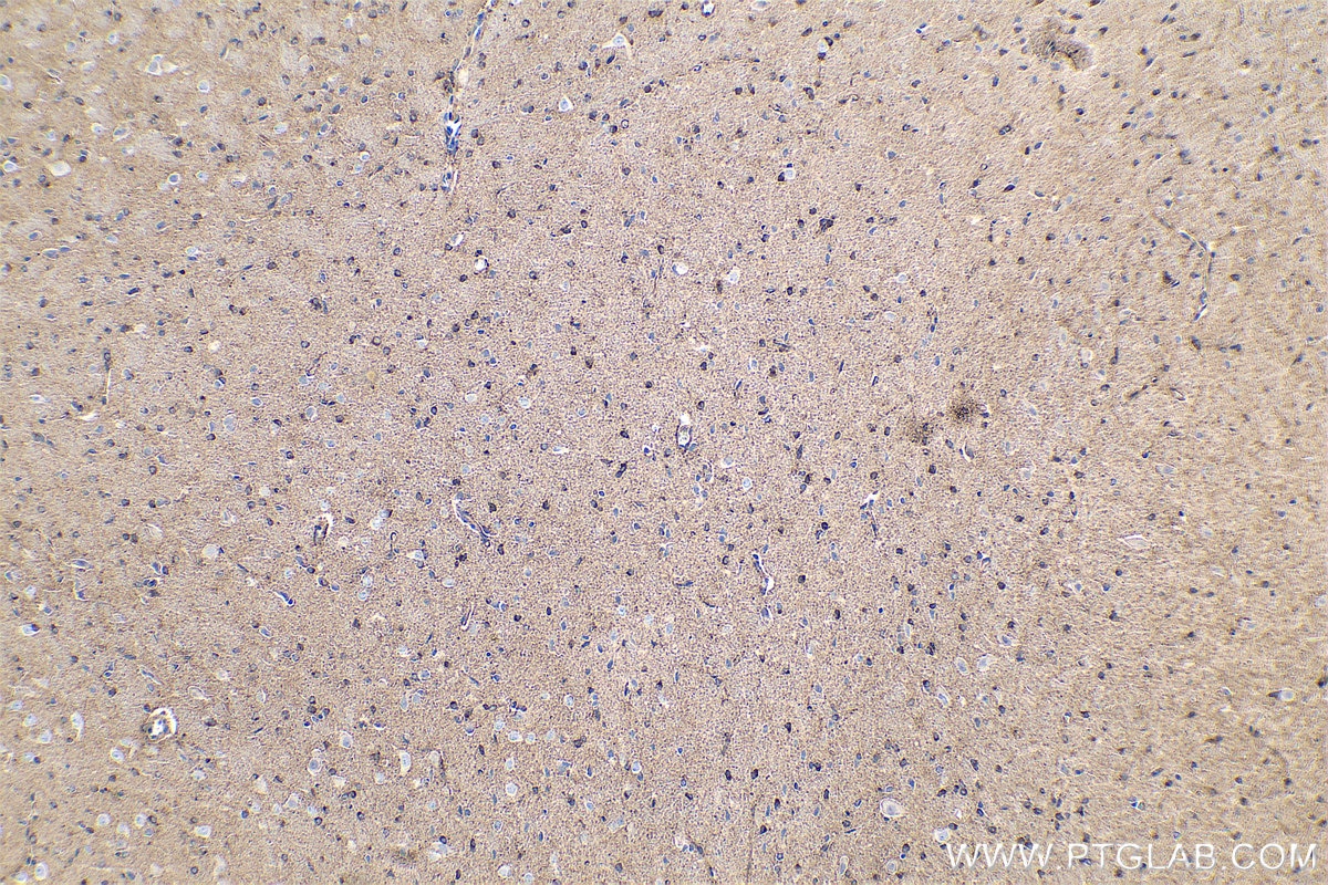 Immunohistochemical analysis of paraffin-embedded rat brain tissue slide using KHC0357 (MYO6 IHC Kit).