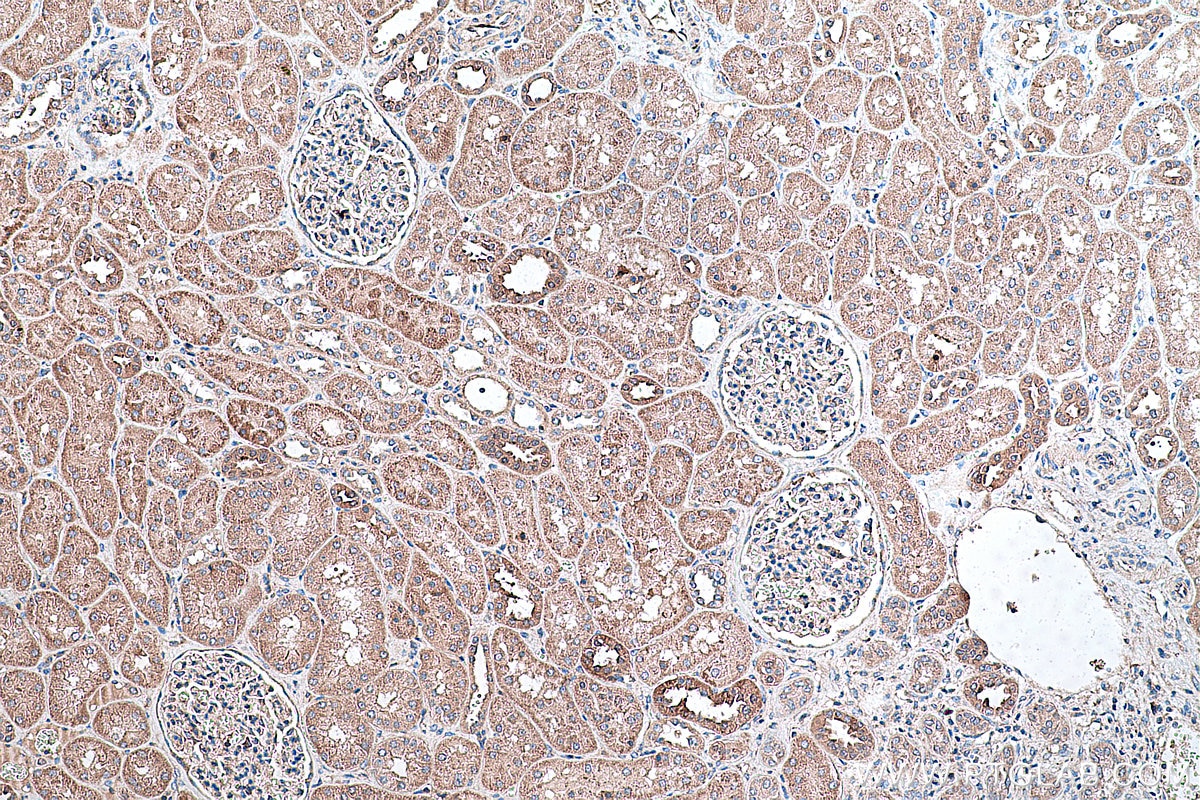 Immunohistochemical analysis of paraffin-embedded human kidney tissue slide using KHC0358 (MYO7A IHC Kit).