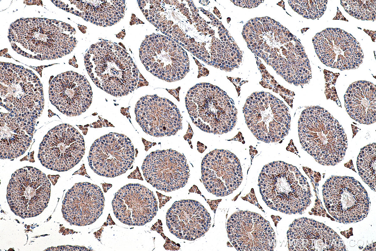 Immunohistochemical analysis of paraffin-embedded mouse testis tissue slide using KHC0358 (MYO7A IHC Kit).