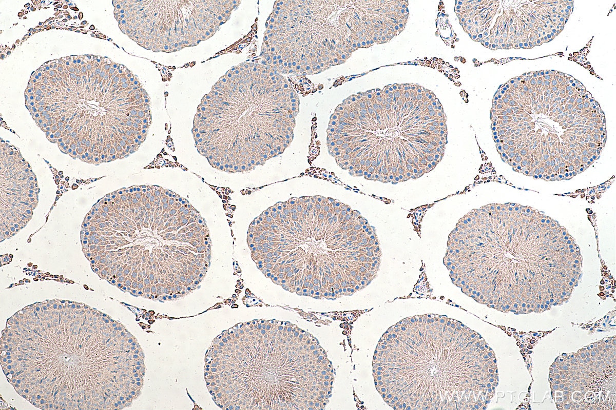 Immunohistochemical analysis of paraffin-embedded rat testis tissue slide using KHC0358 (MYO7A IHC Kit).