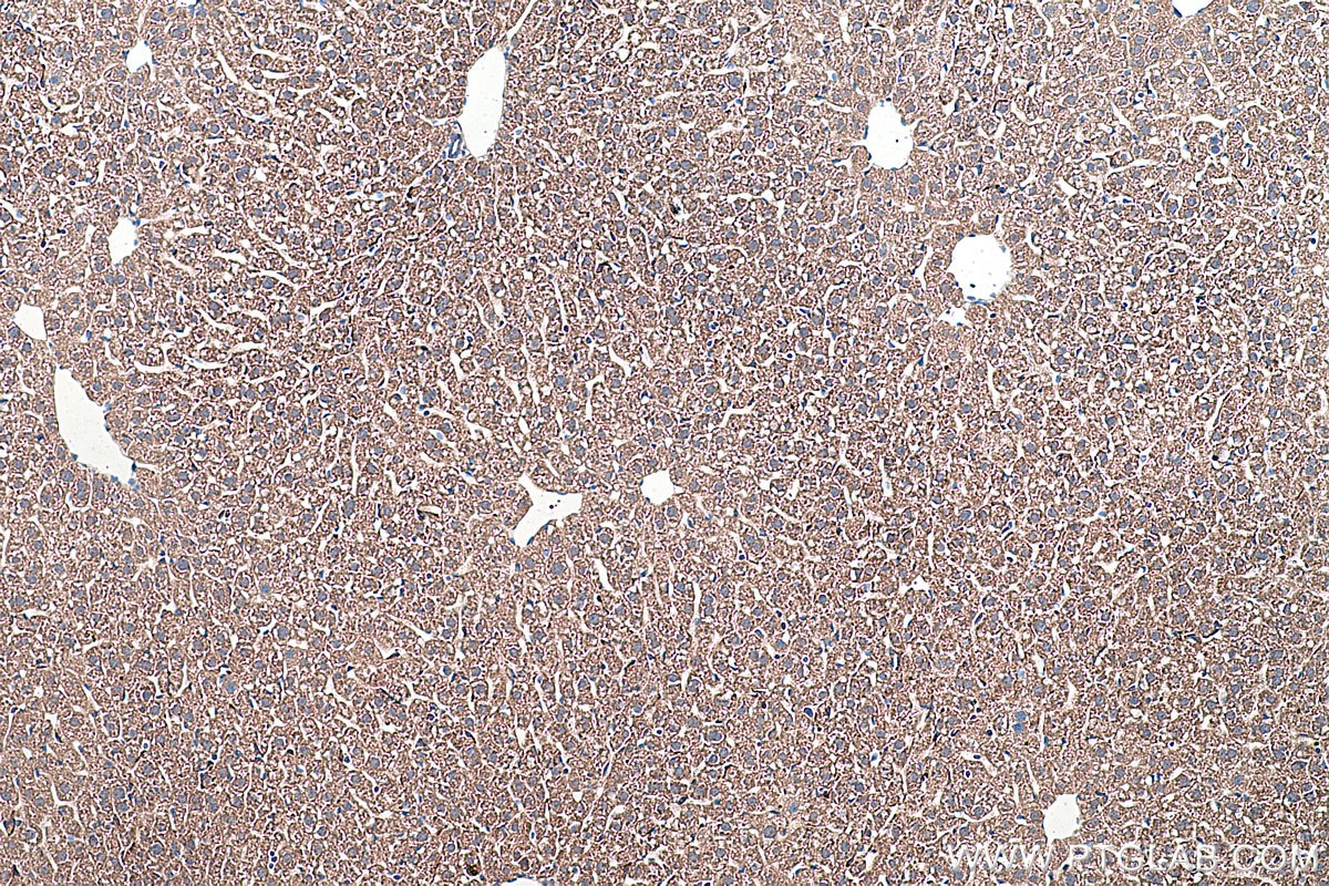 Immunohistochemical analysis of paraffin-embedded mouse liver tissue slide using KHC0358 (MYO7A IHC Kit).
