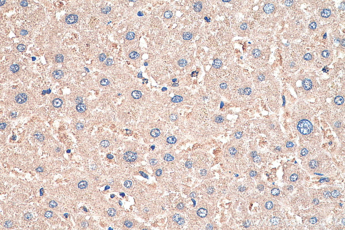 Immunohistochemical analysis of paraffin-embedded human liver tissue slide using KHC0358 (MYO7A IHC Kit).