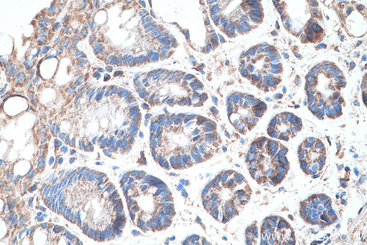 Immunohistochemical analysis of paraffin-embedded mouse colon tissue slide using KHC0371 (MYO9B IHC Kit).