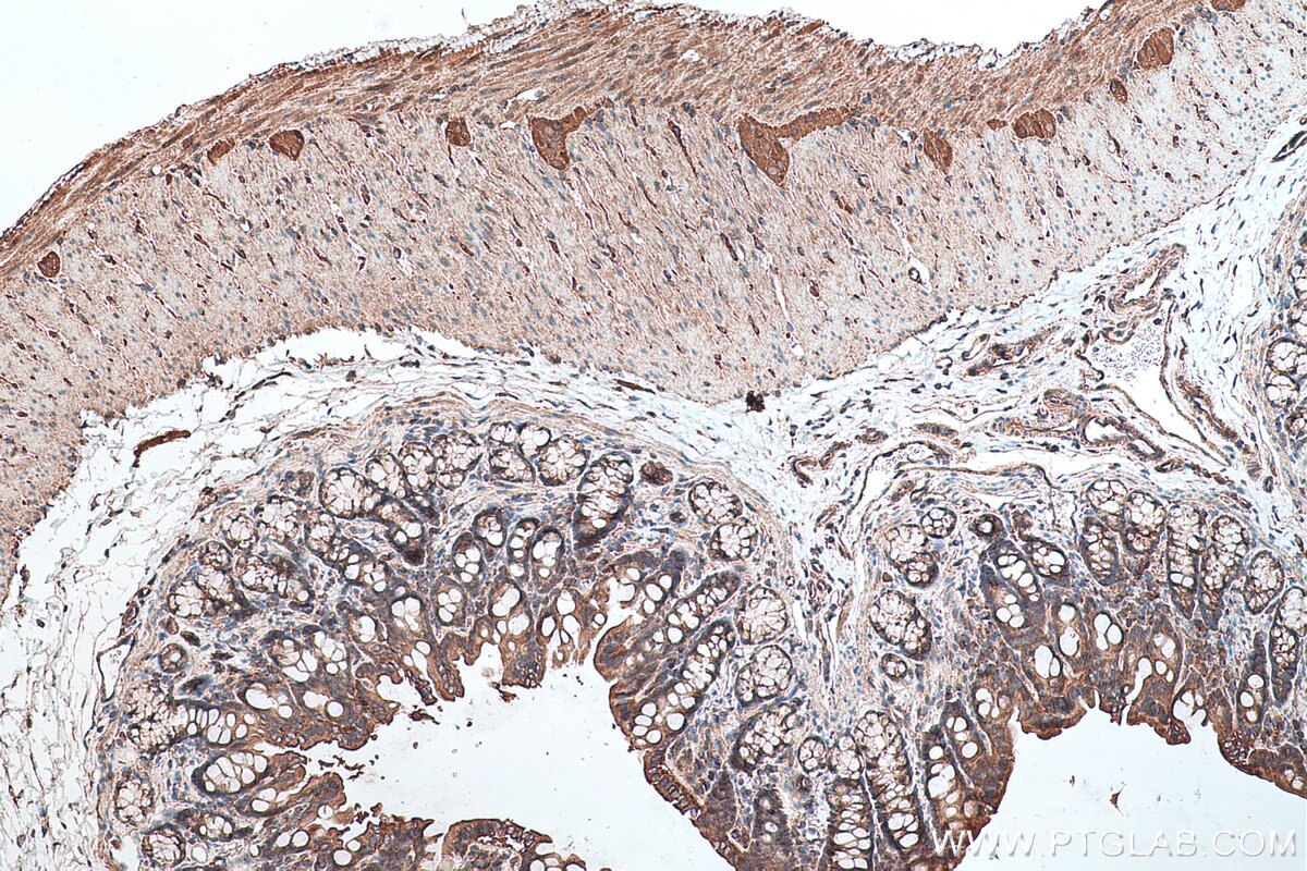 Immunohistochemical analysis of paraffin-embedded rat colon tissue slide using KHC0371 (MYO9B IHC Kit).