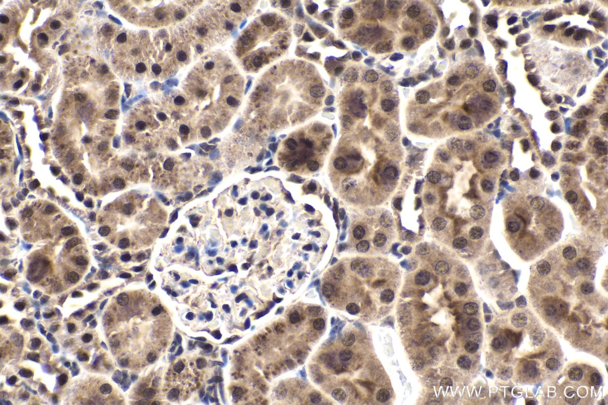 Immunohistochemical analysis of paraffin-embedded rat kidney tissue slide using KHC1781 (MYSM1 IHC Kit).