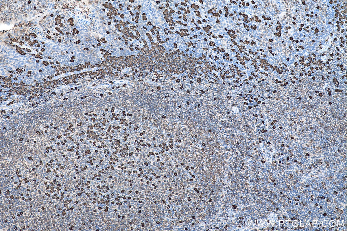 Immunohistochemical analysis of paraffin-embedded human tonsillitis tissue slide using KHC0632 (MZB1 IHC Kit).